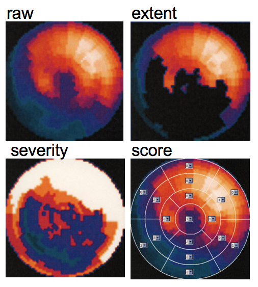 Emory Quantification